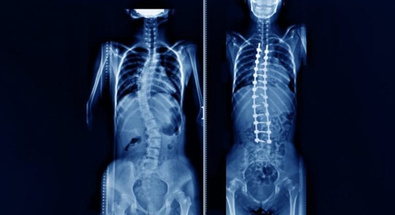 X-ray image of vertebrae